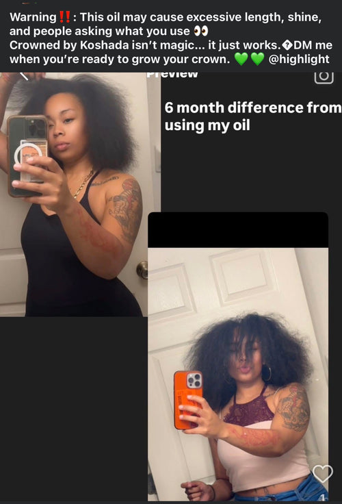 Crowned By Koshada hair growth oil 👸🏽👑